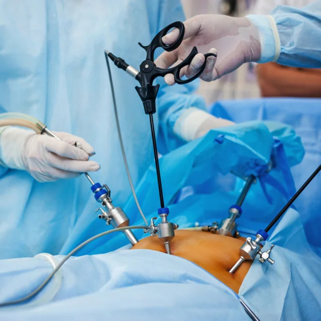 Laparoscopic Surgery